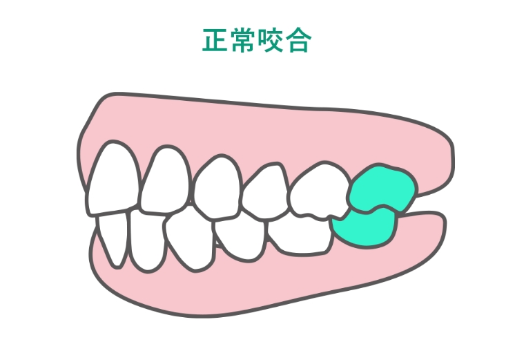 正常咬合