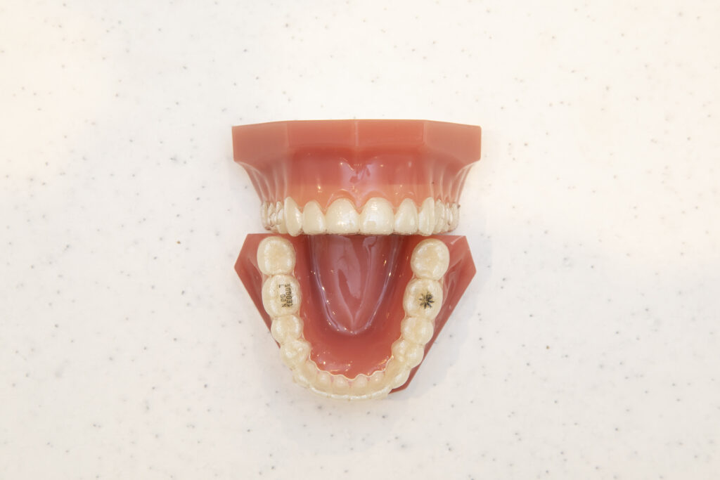 岡山矯正歯科のアライナー矯正（マウスピース矯正）の装置